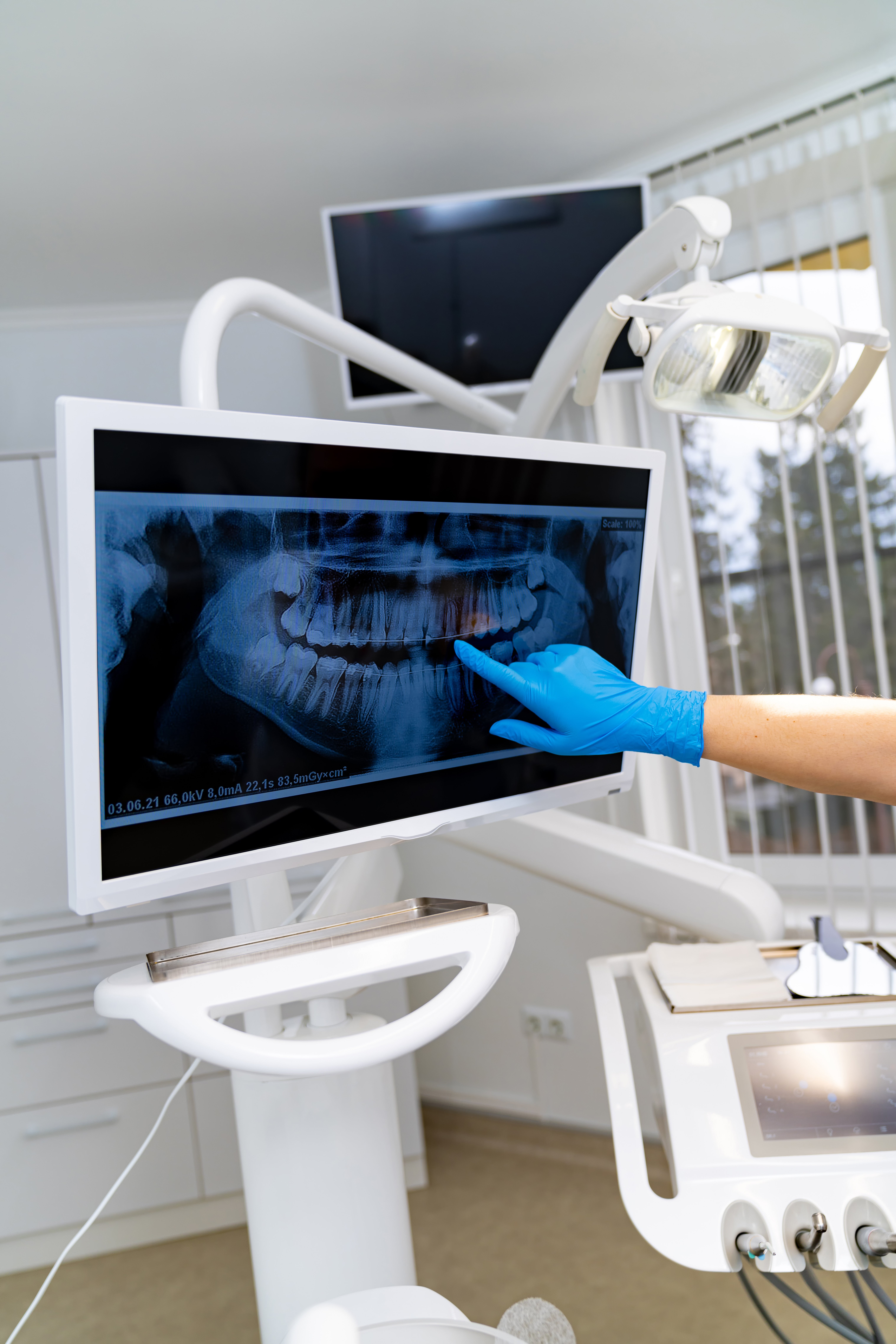 Teeth examining in modern hospital. X-ray dentistry technologies.